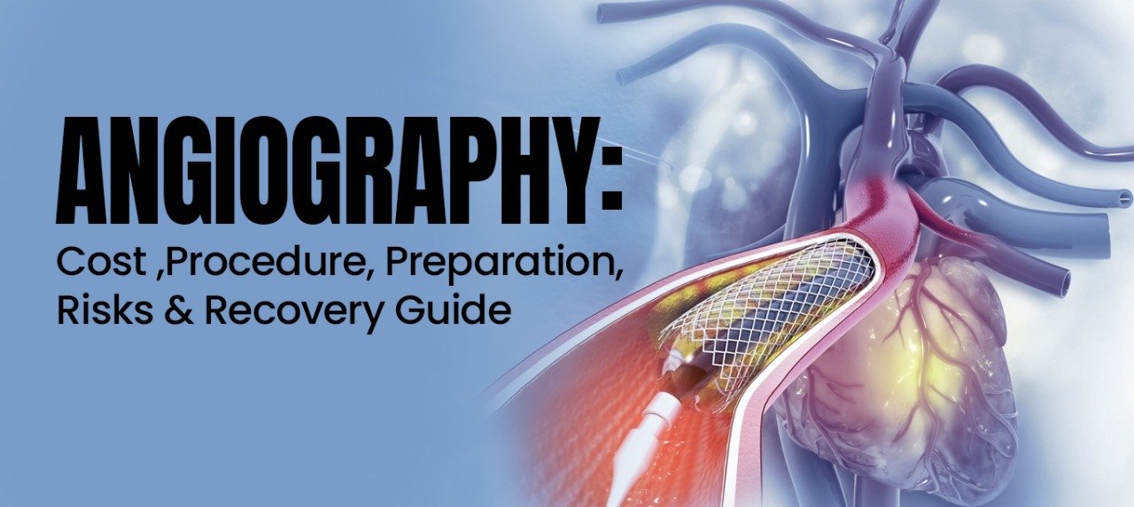 Recovery After Angiography