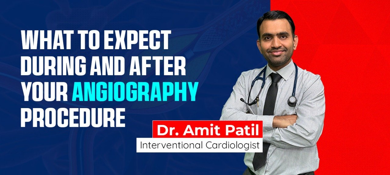 What to Expect During and After Your Angiography Procedure