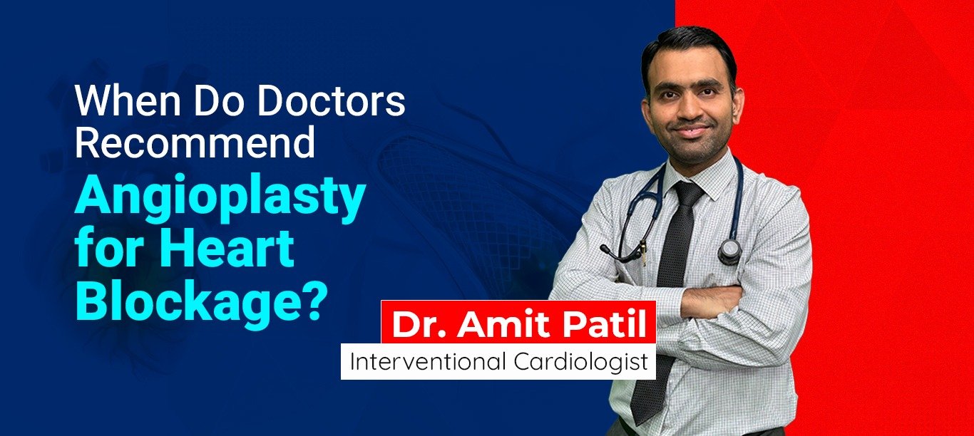 When Do Doctors Recommend Angioplasty