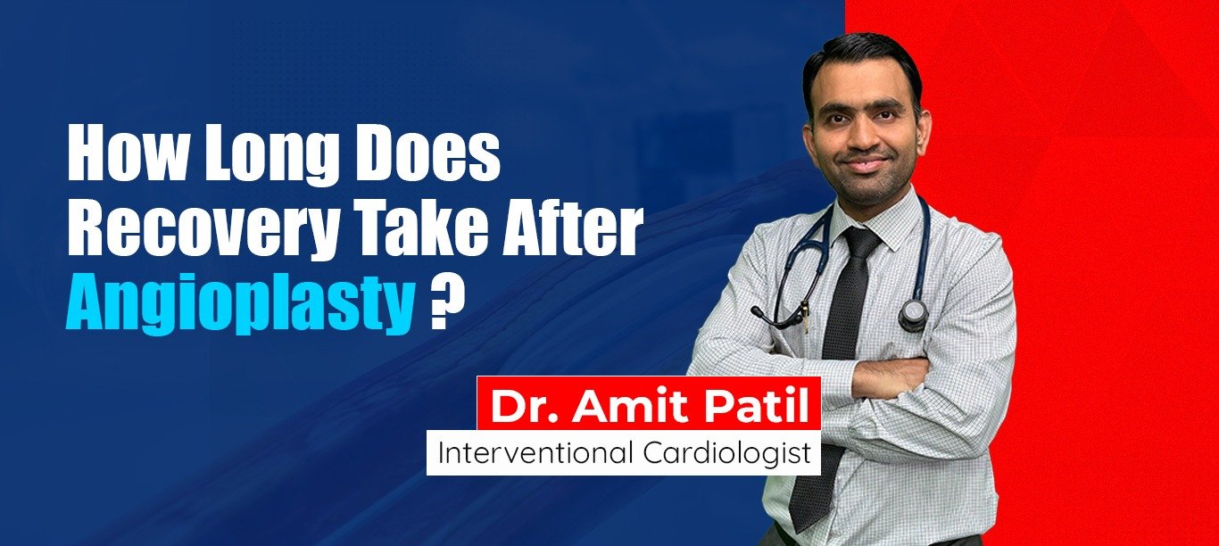 How Long Does Recovery Take After Angioplasty?
