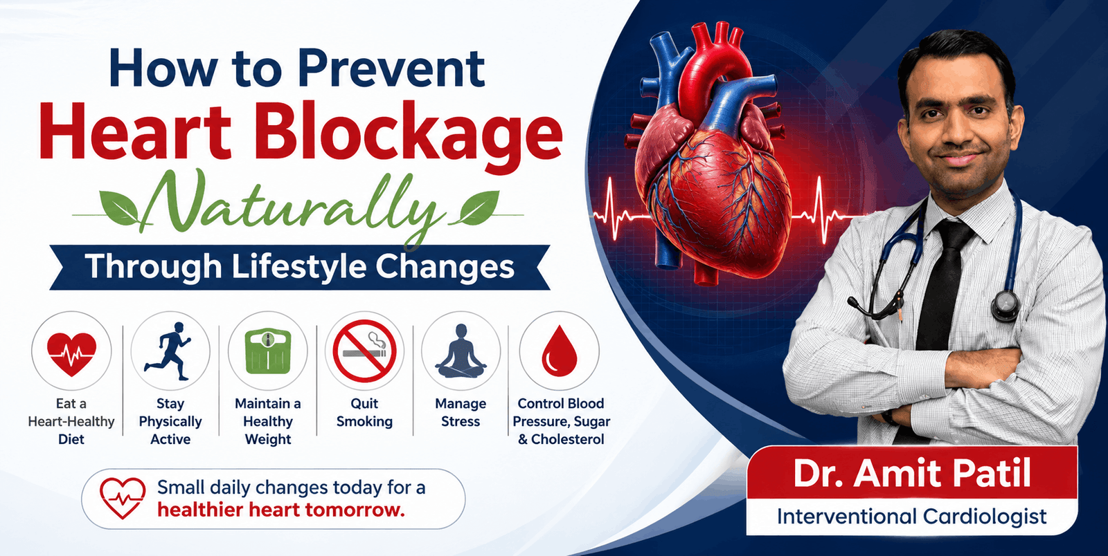 How to Prevent Heart Blockage Naturally Through Lifestyle Changes
