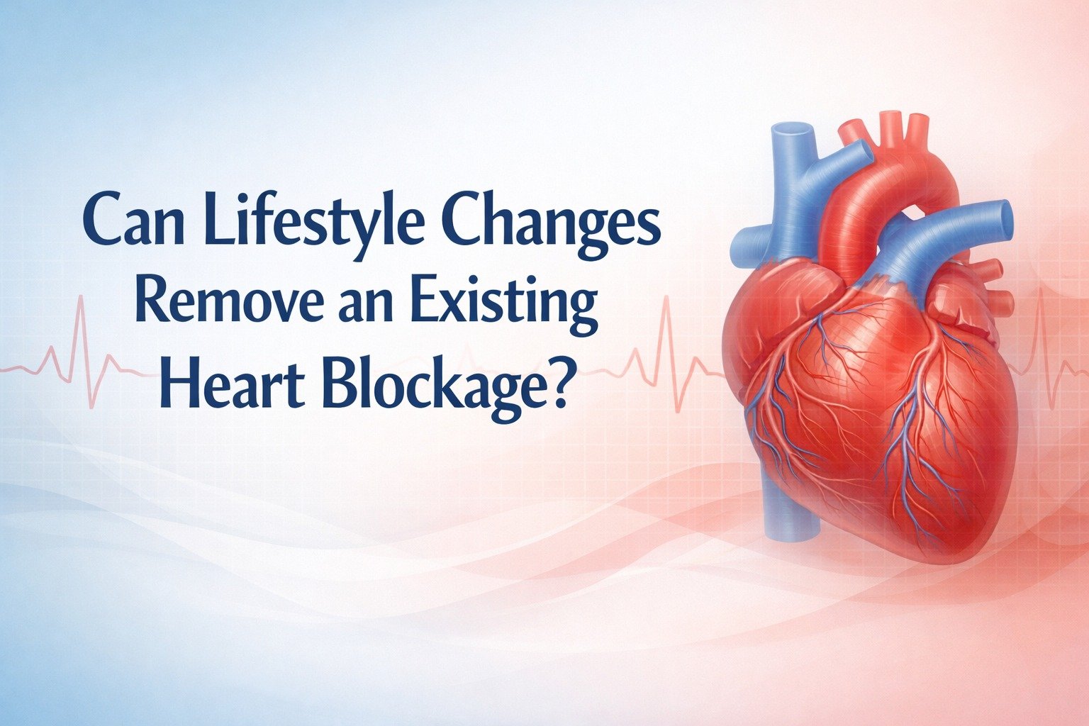 How to Prevent Heart Blockage Naturally Through Lifestyle Changes
